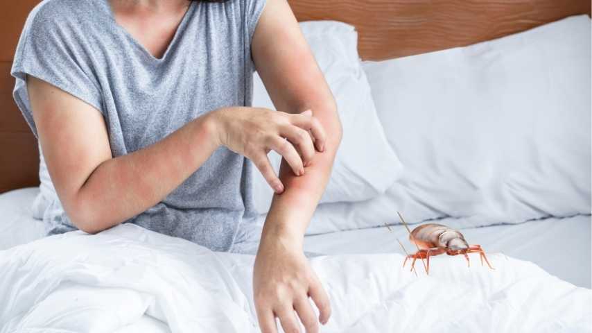 Dấu hiệu có rệp giường